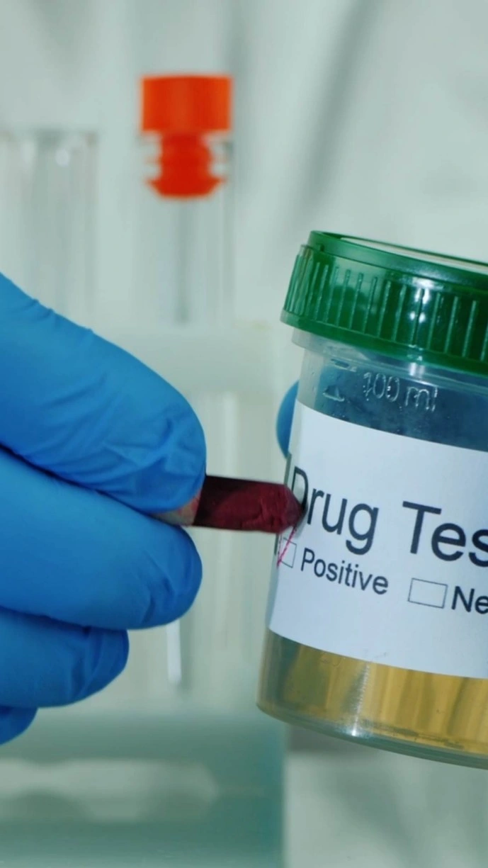 examen de drogas de abuso